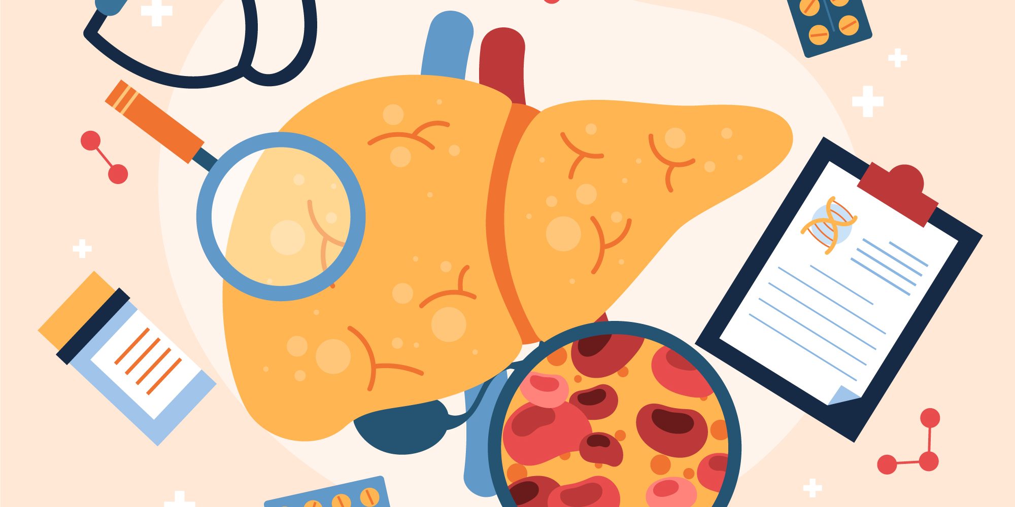 6657031 liver inflammation - hepatitis | Liver specialist in KL | BookDoc