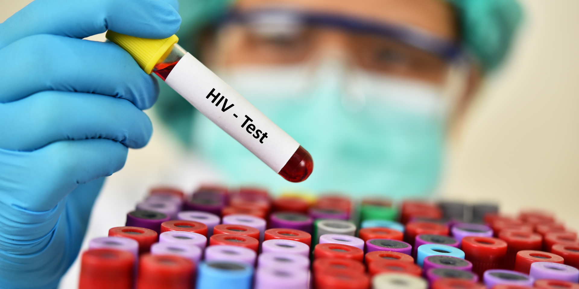 Health Articles | HIV test | BookDoc